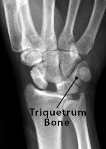Triquetrum Bone Location, Anatomy, Function, & Diagram