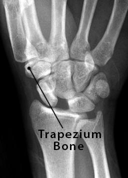 Trapezium Bone Definition, Location, Anatomy, Diagram | The Skeletal System