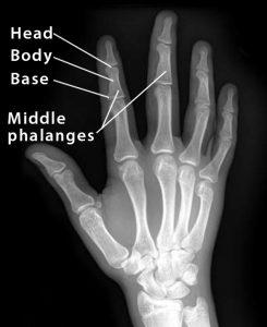 Middle Phalanx: Definition, Location, Anatomy, Diagram