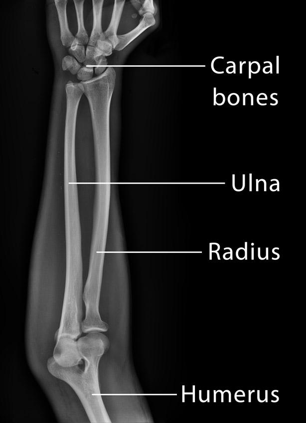 Ulna: Definition, Location, Anatomy, Functions, Diagram