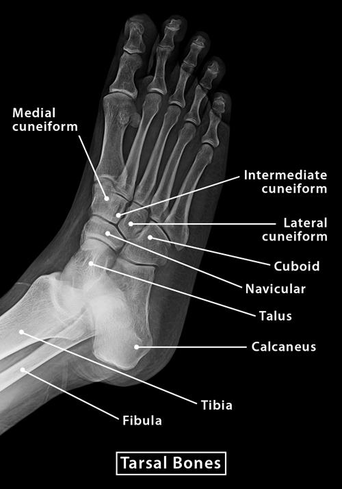 Tarsal Bone Diagram