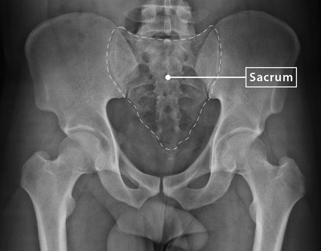 sacrum anatomy xray